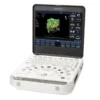 Philips CX50 — портативный УЗИ-аппарат экспертного класса весом 6.17 кг