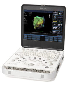 Philips CX50 — УЗИ аппарат
