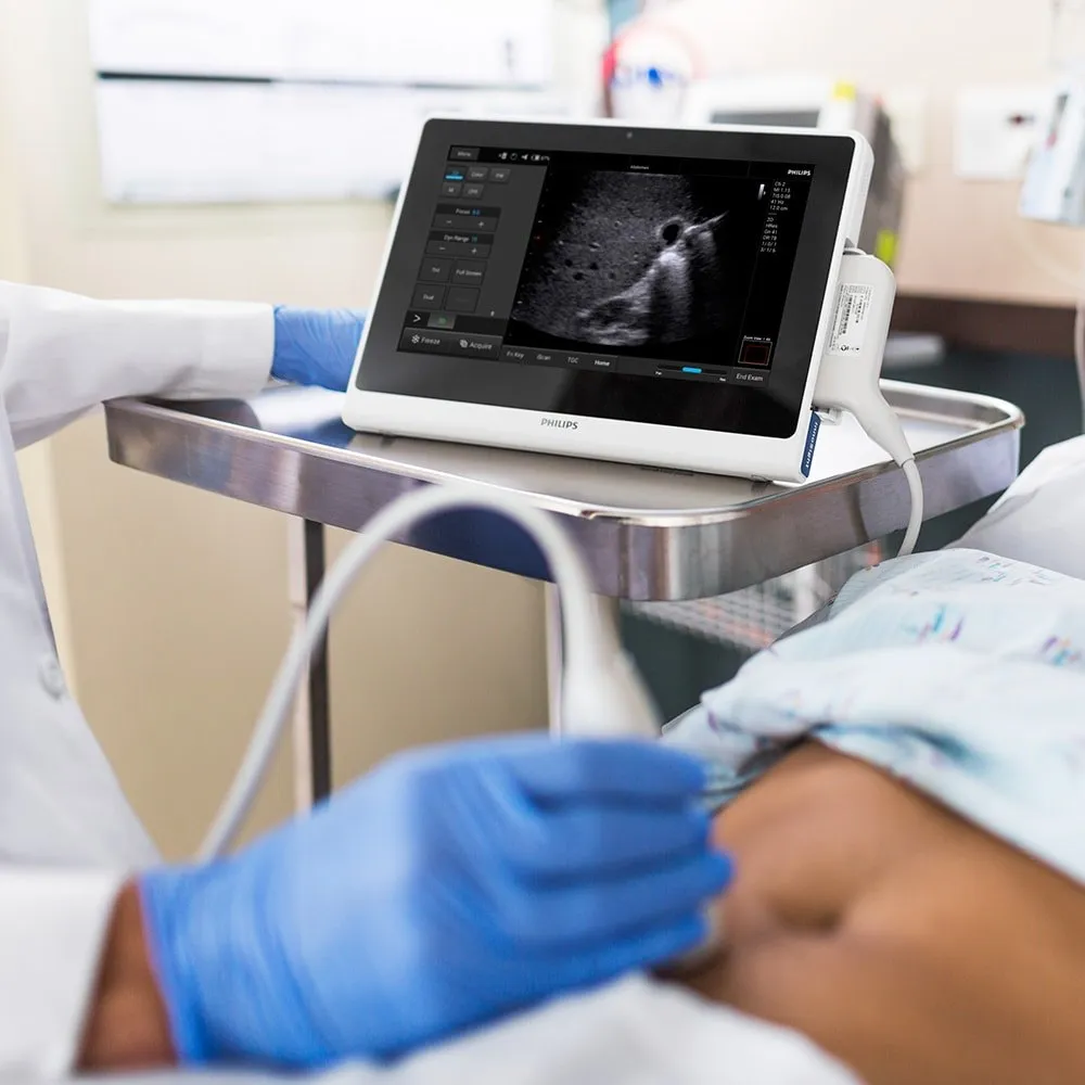 УЗИ Innosight 3 Врач проводит УЗИ-исследование с помощью портативного планшета Philips InnoSight в отделении реанимации или операционной