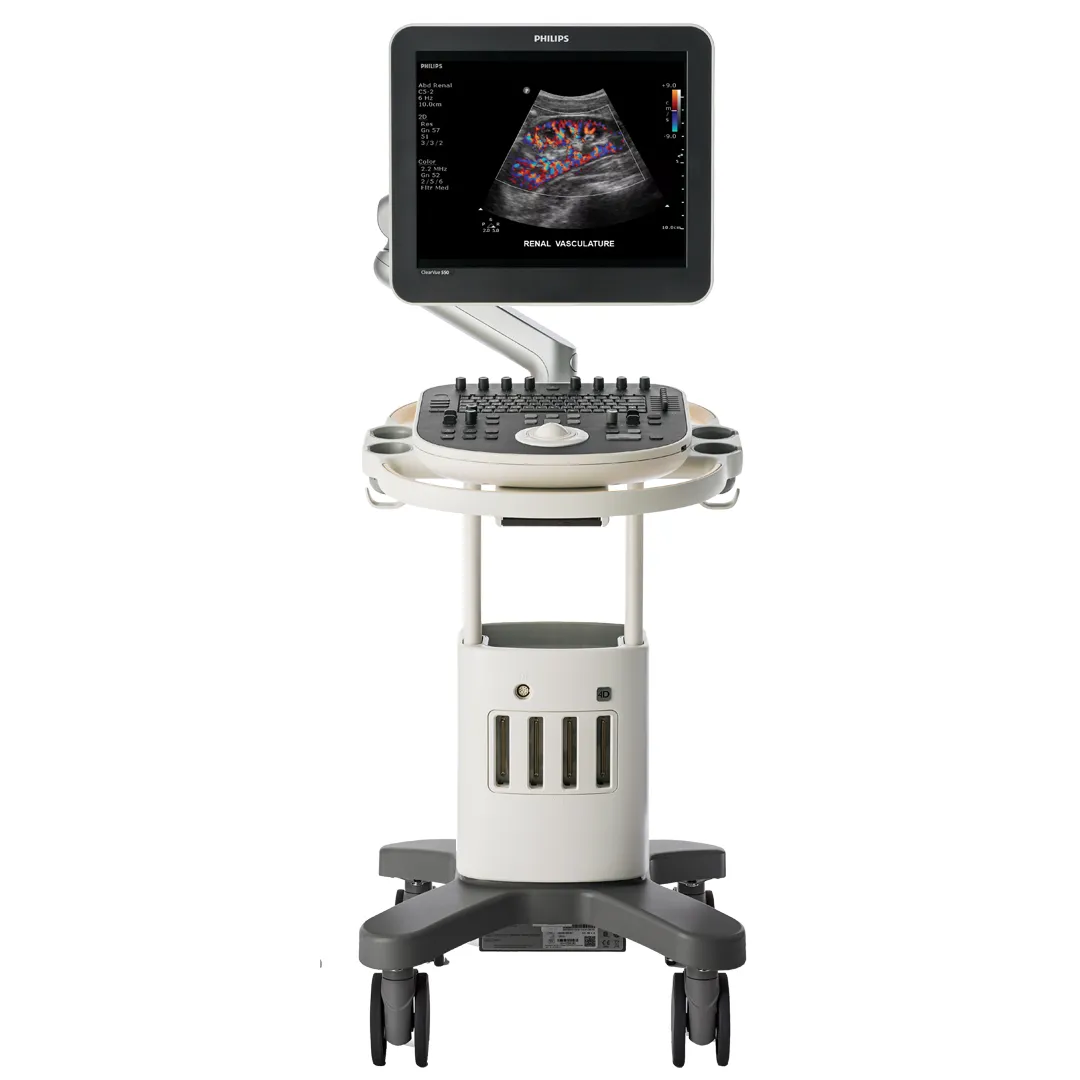УЗИ аппарат Philips ClearVue 550 УЗИ аппарат Philips ClearVue 550 среднего класса с 19-дюймовым экраном и 4 портами для датчиков