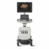 Philips Affiniti 30 УЗИ аппарат стационарный с 21,5″ монитором и сенсорной панелью