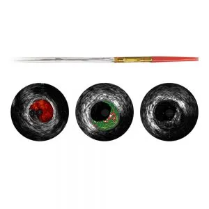 Eagle EYE Platinum — катетер ВСУЗИ