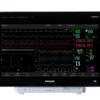 Philips IntelliVue MX750 — флагманский прикроватный монитор пациента с 19-дюймовым Full HD сенсорным экраном