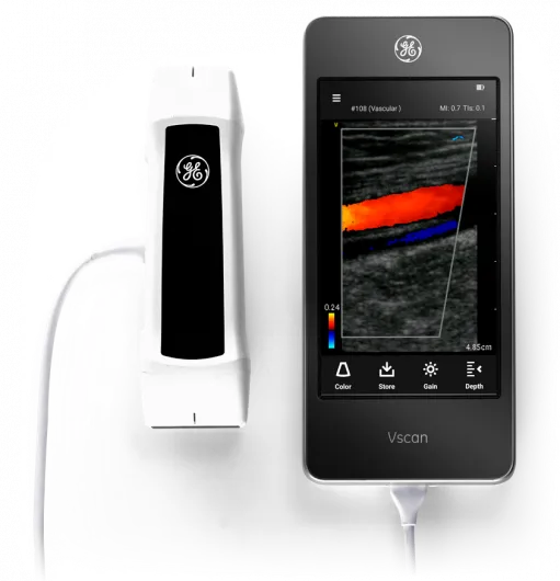 GE Vscan Extend Портативный УЗИ-сканер GE Vscan Extend карманного формата с 5-дюймовым сенсорным экраном и сдвоенным датчиком