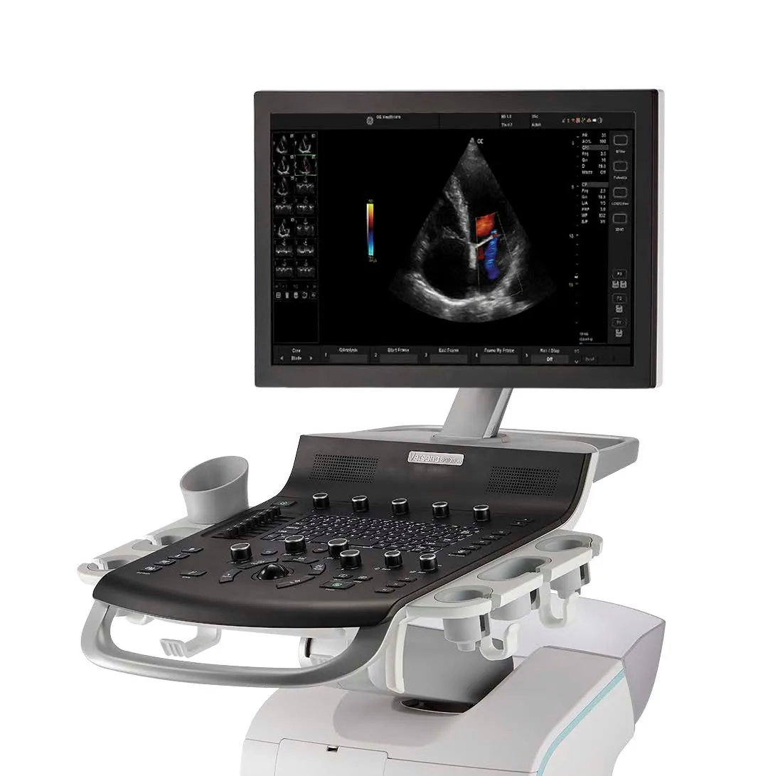 ge versana balance боком Интерфейс GE Versana Balance с режимами B, M, Color Doppler и PW Doppler