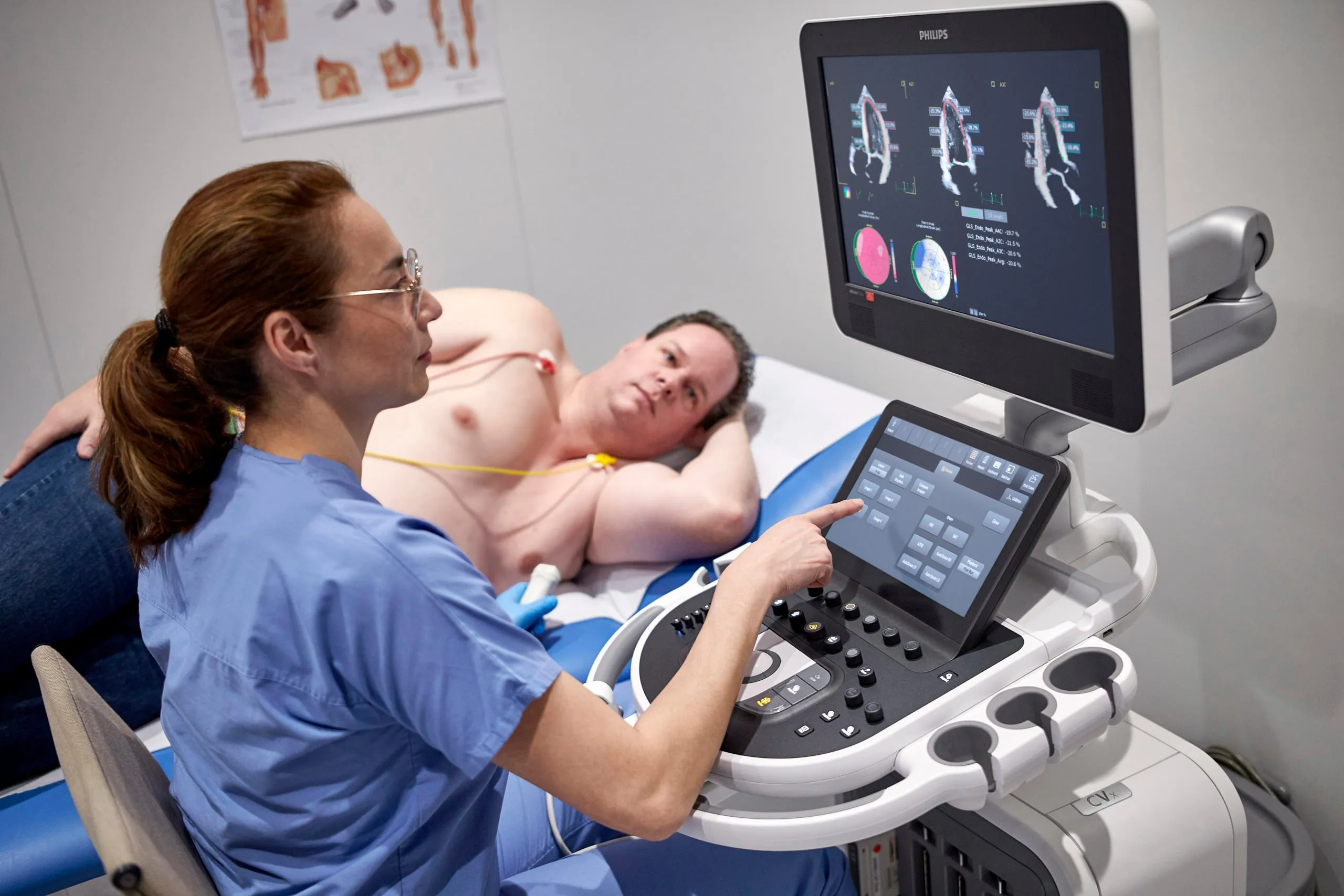 Philips Affiniti CVx сердце фото Врач проводит эхокардиографическое исследование на ультразвуковой системе Philips Affiniti CVx. На мониторе отображается анализ деформации миокарда левого желудочка (AutoStrain LV)/ Пациент лежит на кушетке с электродами ЭКГ на груди.