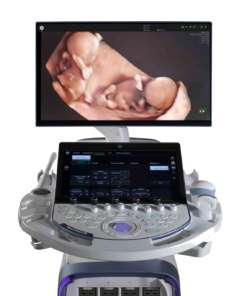 Скрининг плода на GE Voluson Expert 22 с 12-й недели беременности