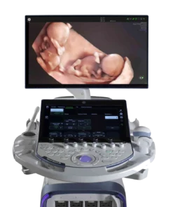 Скрининг плода на GE Voluson Expert 22 с 12-й недели беременности