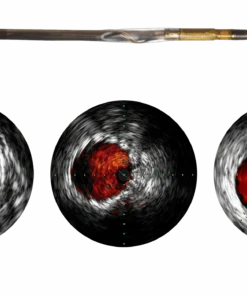 Visions PV .018 — цифровой катетер для ВСУЗИ Philips для проводника 0.018″