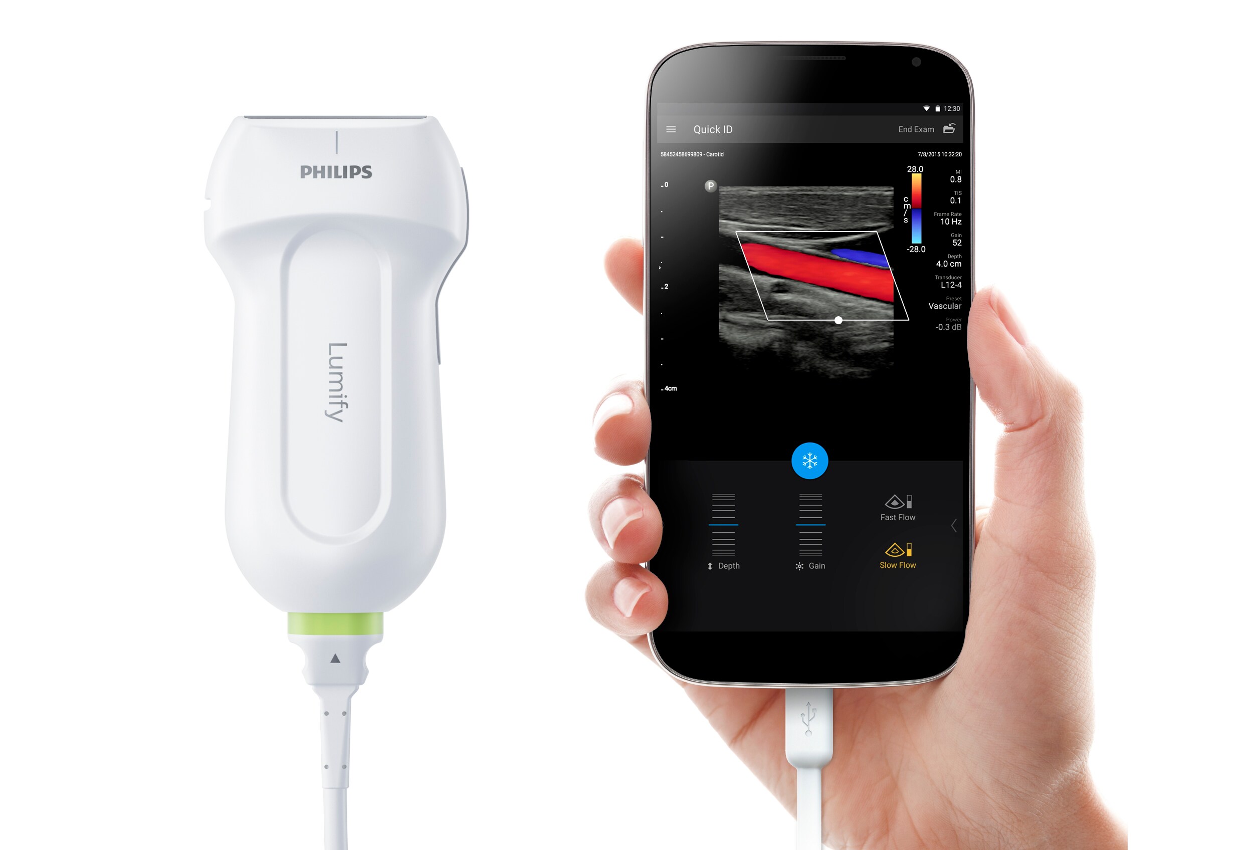 Цветовой допплер на ультрапортативной системе Philips Lumify Режим допплера на Philips Lumify