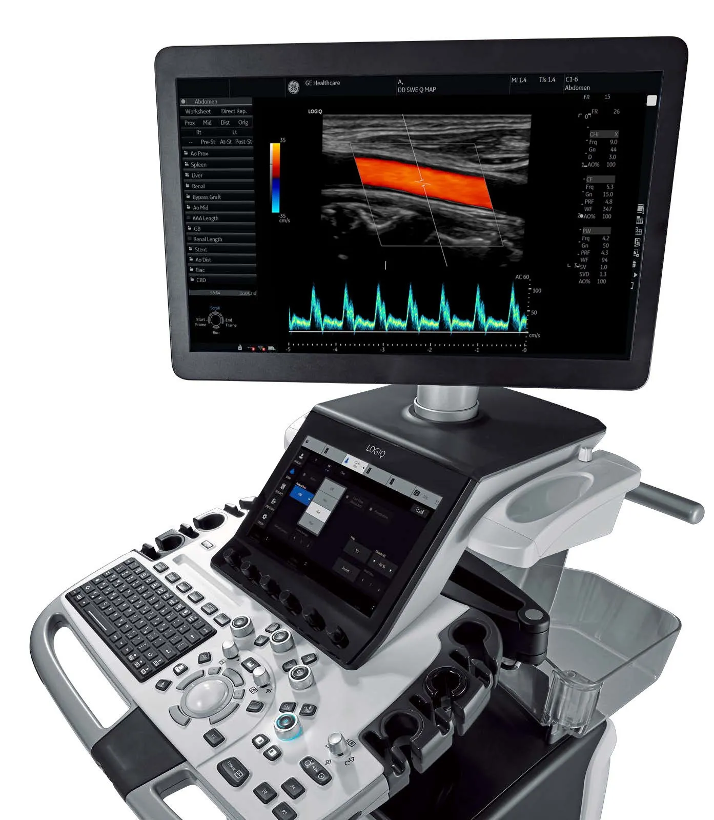 ge logiq_e10_Импульсно-волновой допплер GE Logiq E10 с 22-дюймовым OLED-монитором Full HD и импульсно-волновым допплером
