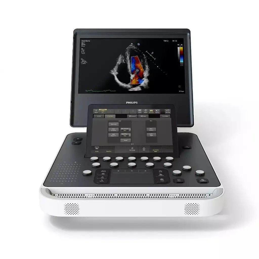 Philips 5500 тканевой допплер 5500 Портативная ультразвуковая система Philips 5500. На верхнем мониторе отображается эхокардиограмма с цветным допплером, ниже — наклонная сенсорная панель управления и основная консоль с клавишами.