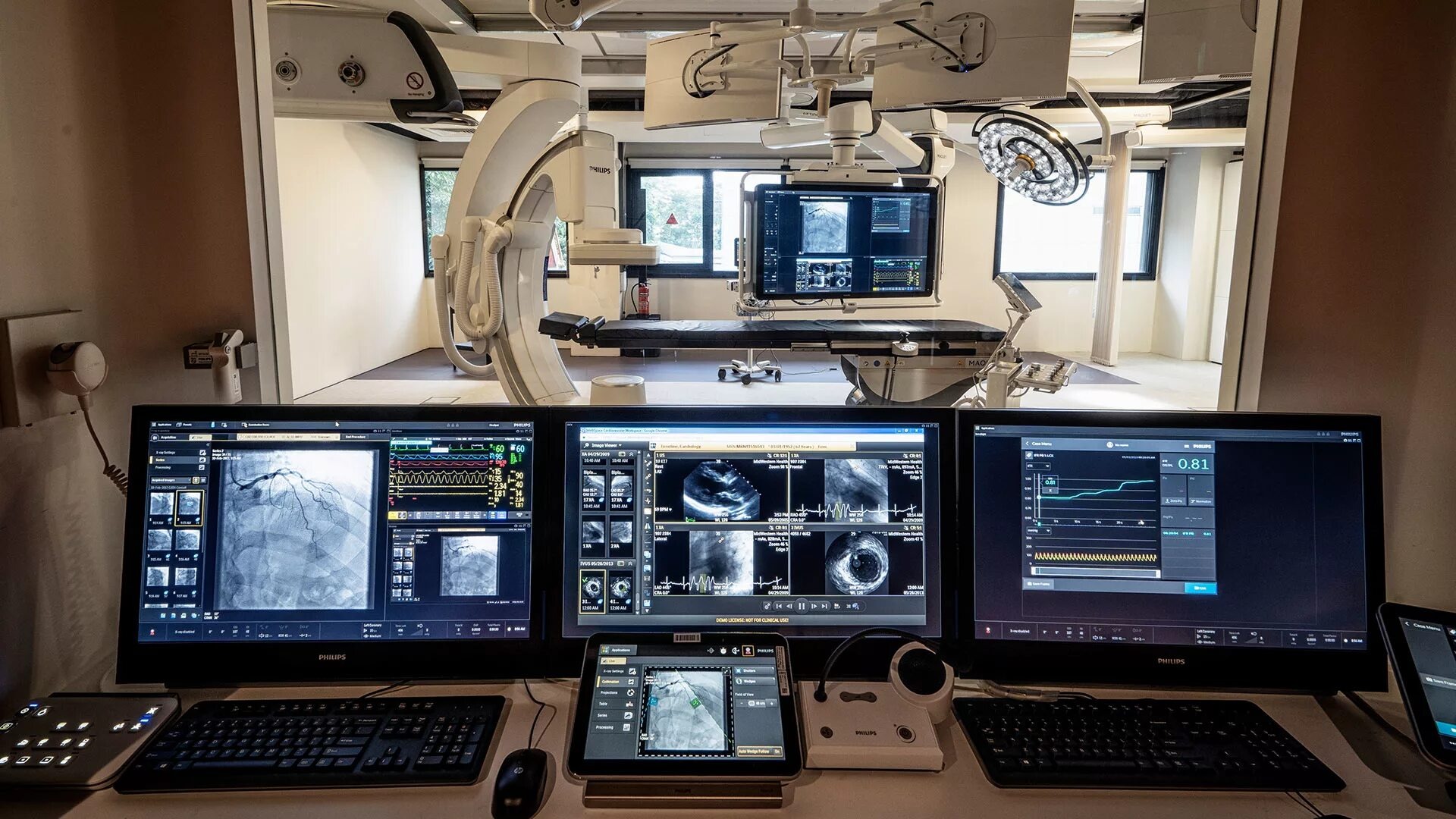 Philips Azurion 7 со штативом FlexArm может вращаться вокруг восьми осей. Данные, полученные на ангиографе, на мониторах