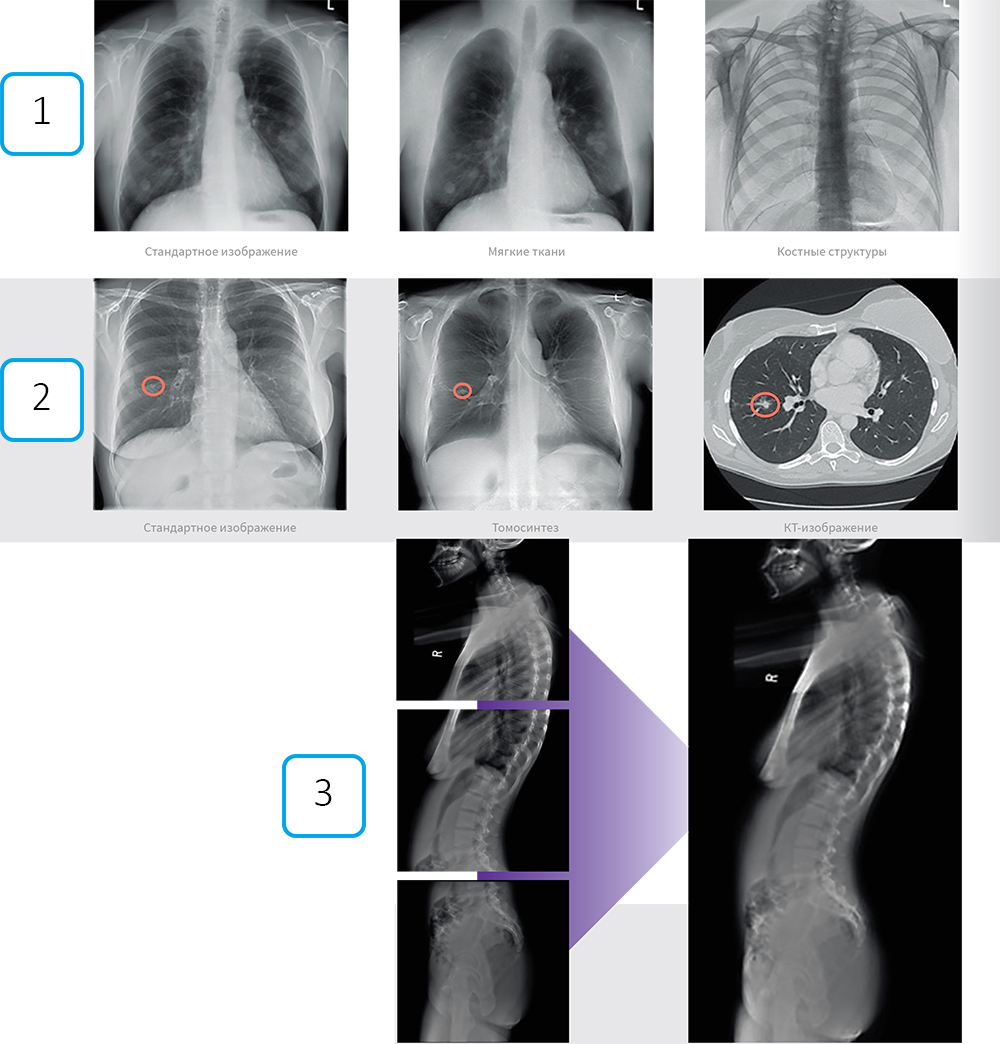 Рентгеновские снимки грудной клетки в разных проекциях. Рентгеновские снимки грудной клетки