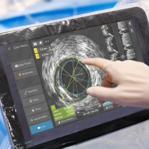 ВСУЗИ катетер Philips Volcano — внутрисосудистый ультразвук коронарных артерий