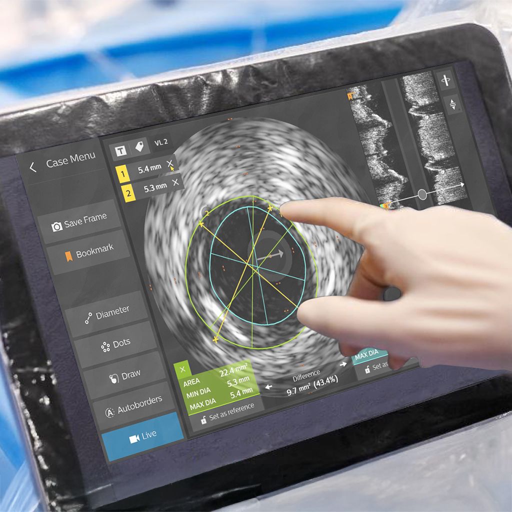 ВСУЗИ катетер Philips Volcano — внутрисосудистый ультразвук коронарных артерий