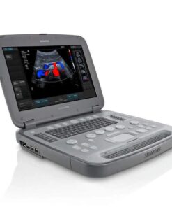 Siemens Acuson P500 — УЗИ аппарат