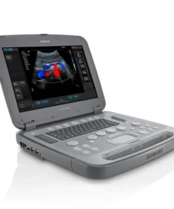 Acuson P500