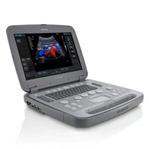 Siemens Acuson P500 — УЗИ аппарат