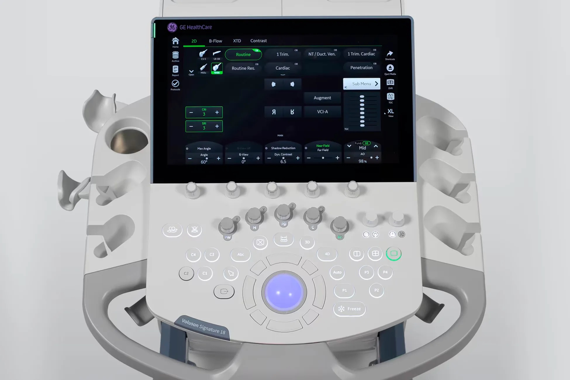 GE Voluson Signature 18 3 УЗИ система GE Voluson Signature 18 с 14-дюймовой сенсорной панелью xTouch