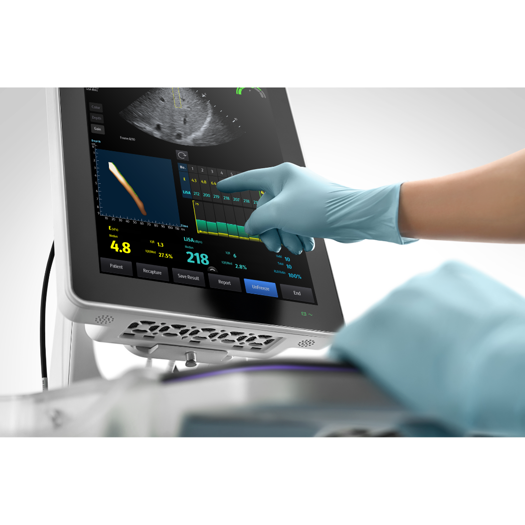 Minday Hepatus рука Стационарный УЗИ аппарат Mindray Hepatus 6 для комплексной гастроэнтерологической диагностики