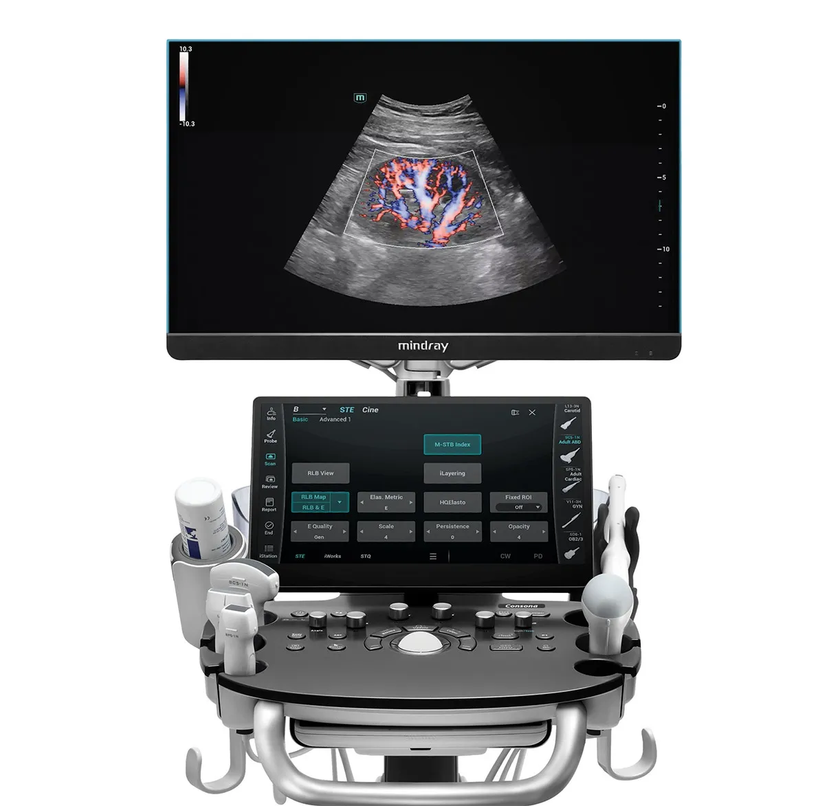 Mindray_Consona_N9_Ultrasound_ Интерфейс Mindray Consona N9 с платформой ZST+ и режимами B, M, Color Doppler, эластографией STE