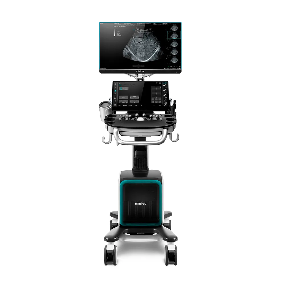 consona N9 (1) Mindray Consona N9 с 23.8-дюймовым монитором и 15.6-дюймовой сенсорной панелью с плавающим креплением