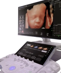 Скрининг плода в 4D на GE Voluson Signature 20 с технологией HDlive Studio+