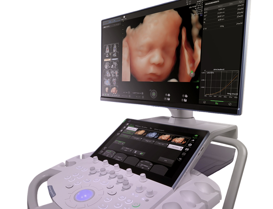 ge voluson-signature-20 2 Скрининг плода в 4D на GE Voluson Signature 20 с технологией HDlive Studio+