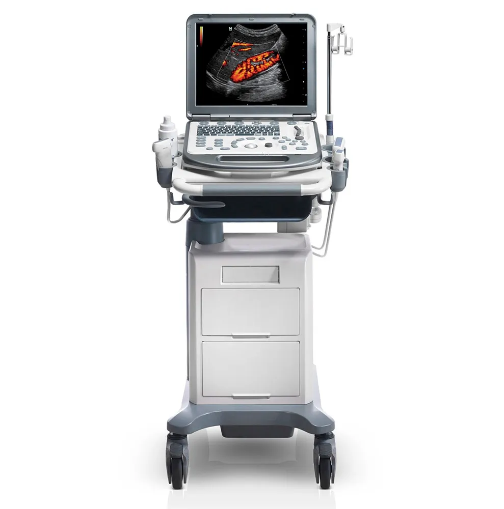 mindray m6_на тележке Портативный УЗИ Mindray M6 на тележке