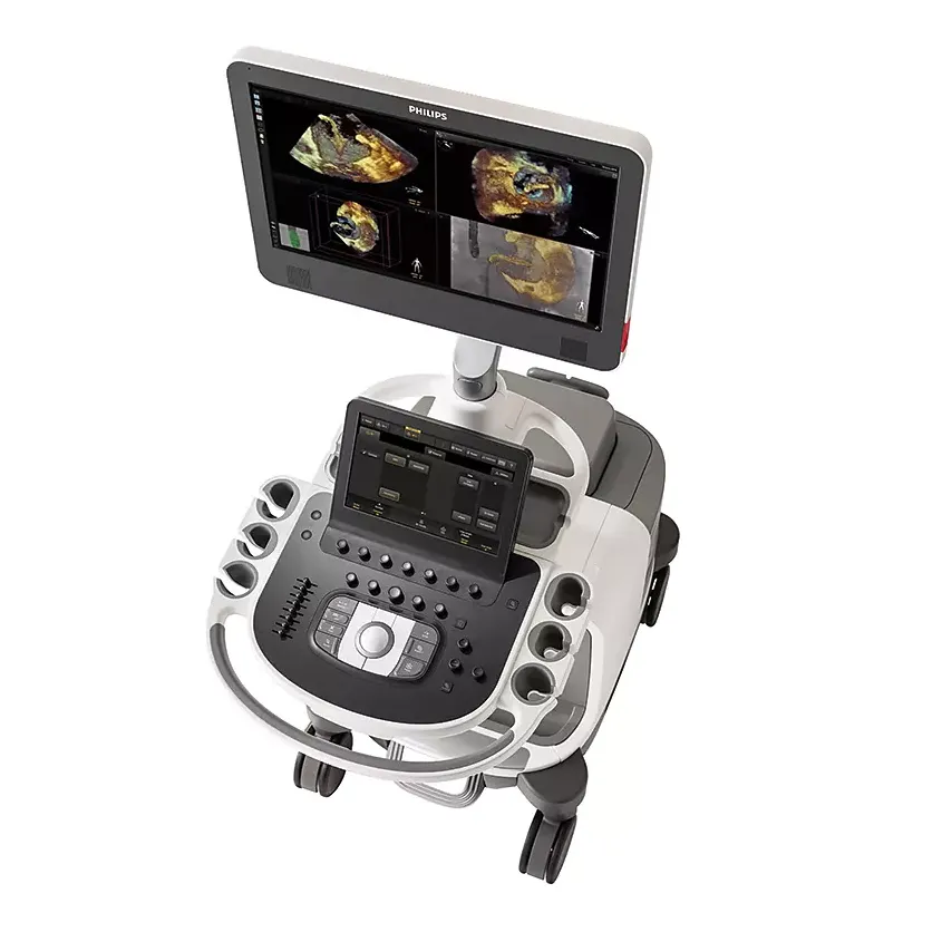 Philips Epiq CVx вверх На большом мониторе Philips EPIQ CVx. отображаются объёмные 3D-изображения сердца в нескольких проекциях