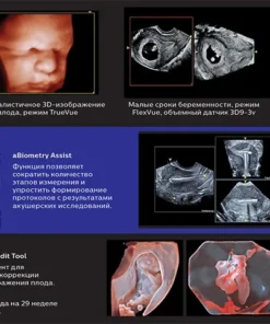 Коллаж УЗИ на Philips 5500: пренатальная визуализация — мозг и 3D-лицо плода, FlexVue, допплер пуповины, инструменты aBiometry Assist, 3D Auto Edit, GlassVue.