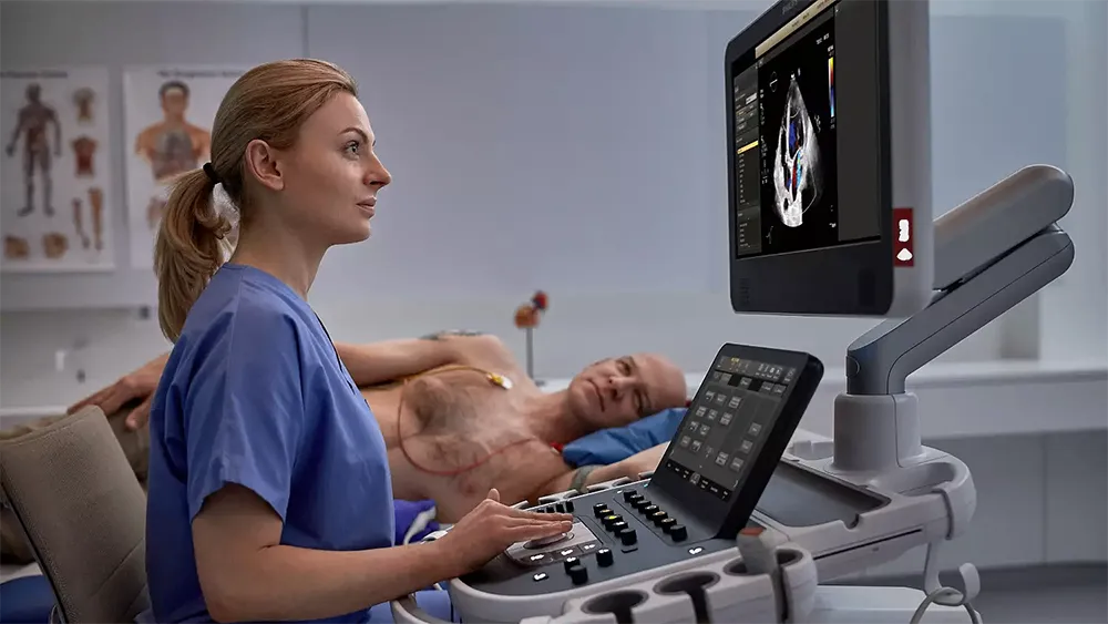 Philips_Epiq_CVx 3 Врач проводит эхокардиографическое исследование на ультразвуковой системе Philips EPIQ CVx. На мониторе отображается изображение сердца с цветным допплером/ Пациент лежит на кушетке с электродами ЭКГ на груди.