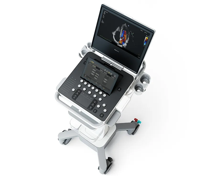 Ultrasound_Compact5500 Echo копия УЗИ-система Philips 5500 на мобильной стойке: монитор с эхокардиограммой, сенсорная панель и консоль управления.
