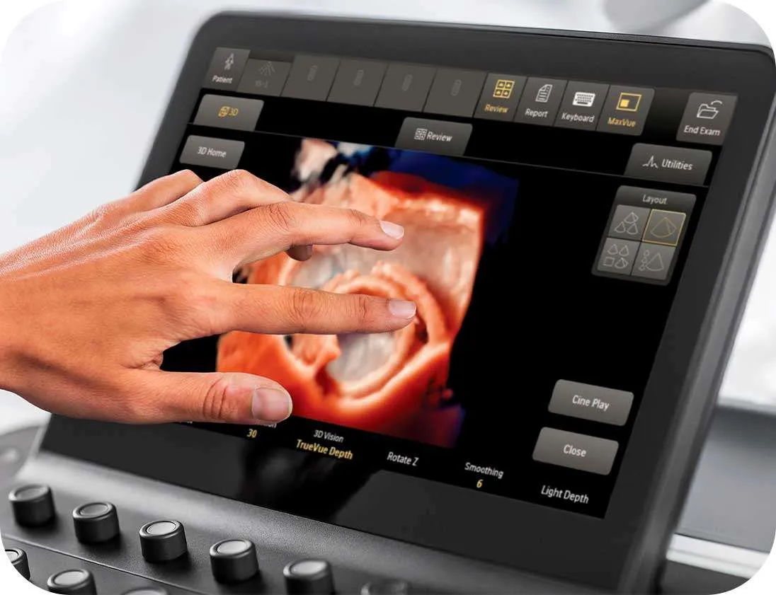 philips-epiq-cvx-2 Врач управляет сенсорным экраном Philips EPIQ CVx с 3D-изображением сердца (TrueVue).