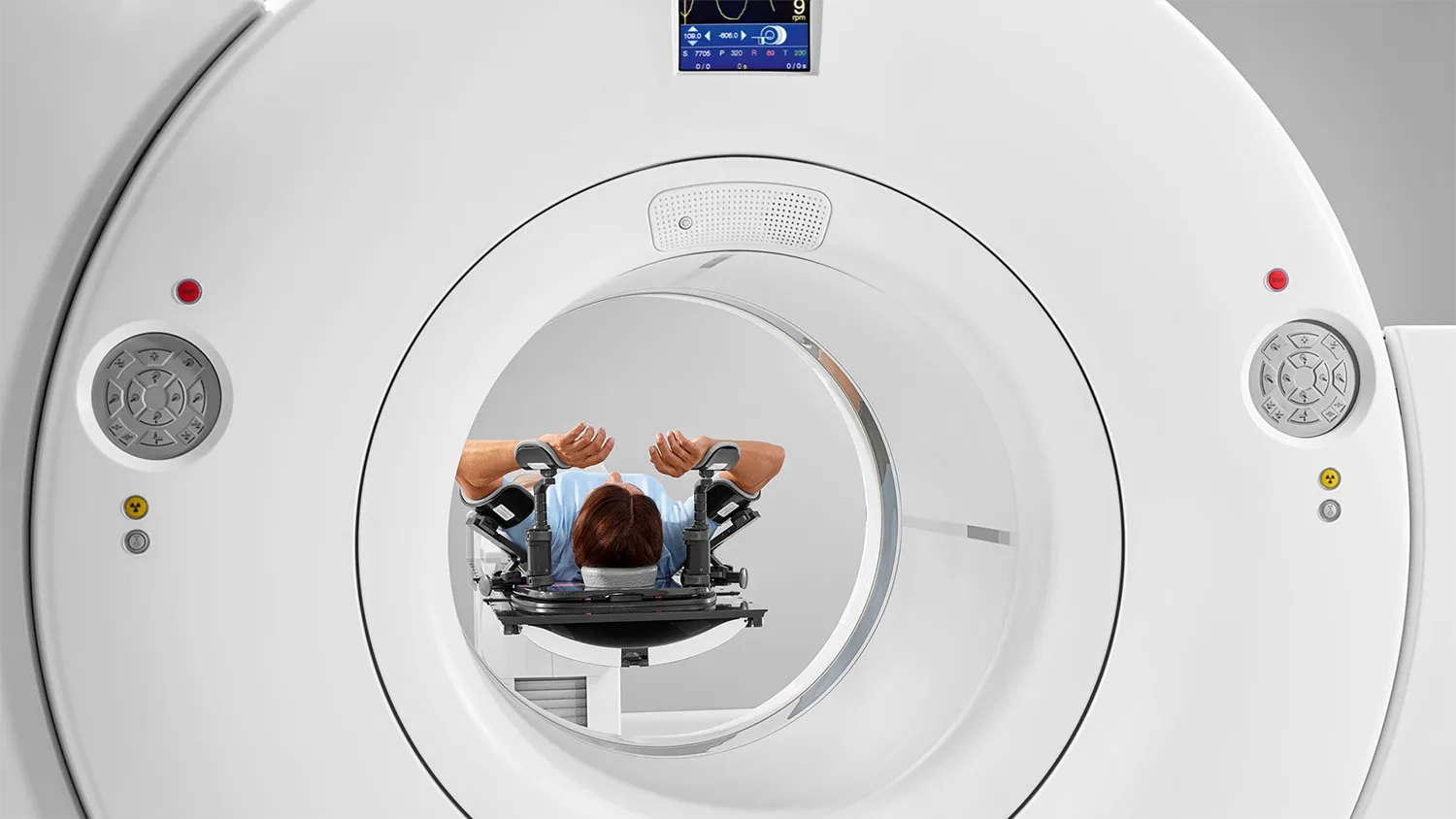 siemens-healthineers_MI_biograph-vision-pet-ct Широкая апертура 78 см ПЭТ/КТ системы Siemens Biograph Vision для комфортного сканирования пациентов