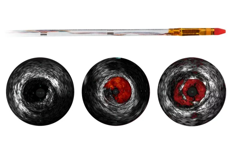 Eagle Eye Platinum ST — Катетеры ВСУЗИ