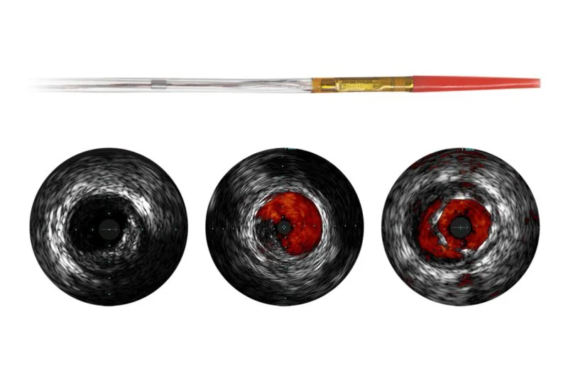 Eagle Eye Platinum — Катетеры ВСУЗИ